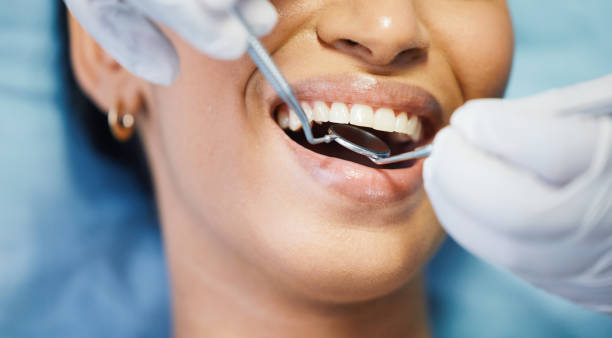 Best Emergency Cosmetic Dentistry (e.g., broken veneers) in Bear Valley Springs, CA